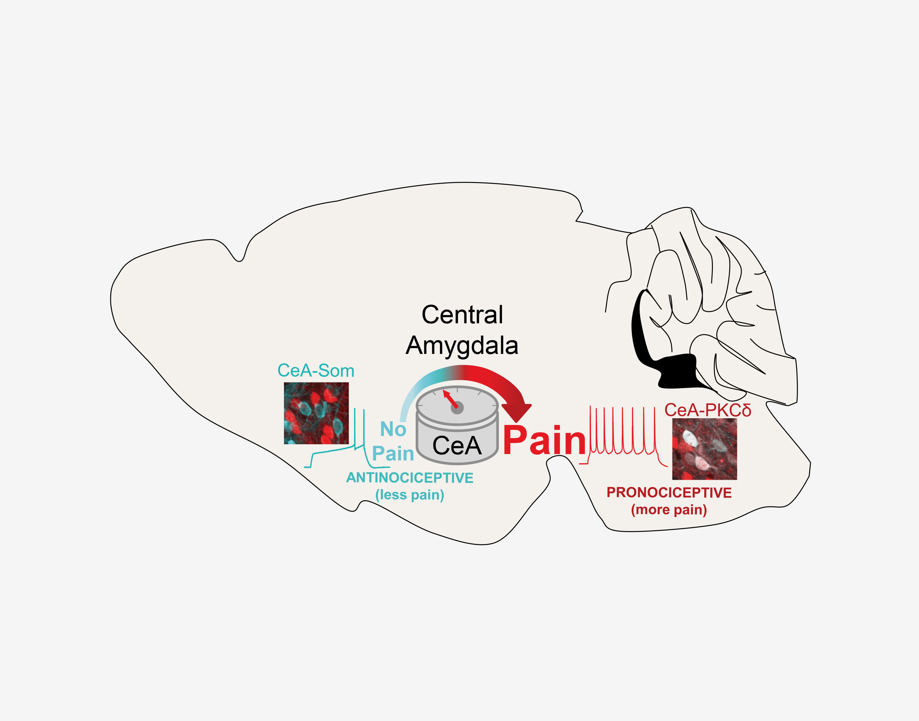 The central amygdala (CeA) functions as a pain rheostat in the forebrain, enhancing or attenuating pain. Modulation of pain is accomplished by cell-type-specific changes in activity after injury. Activity in CeA-PKCδ neurons drives increases in pain-relat