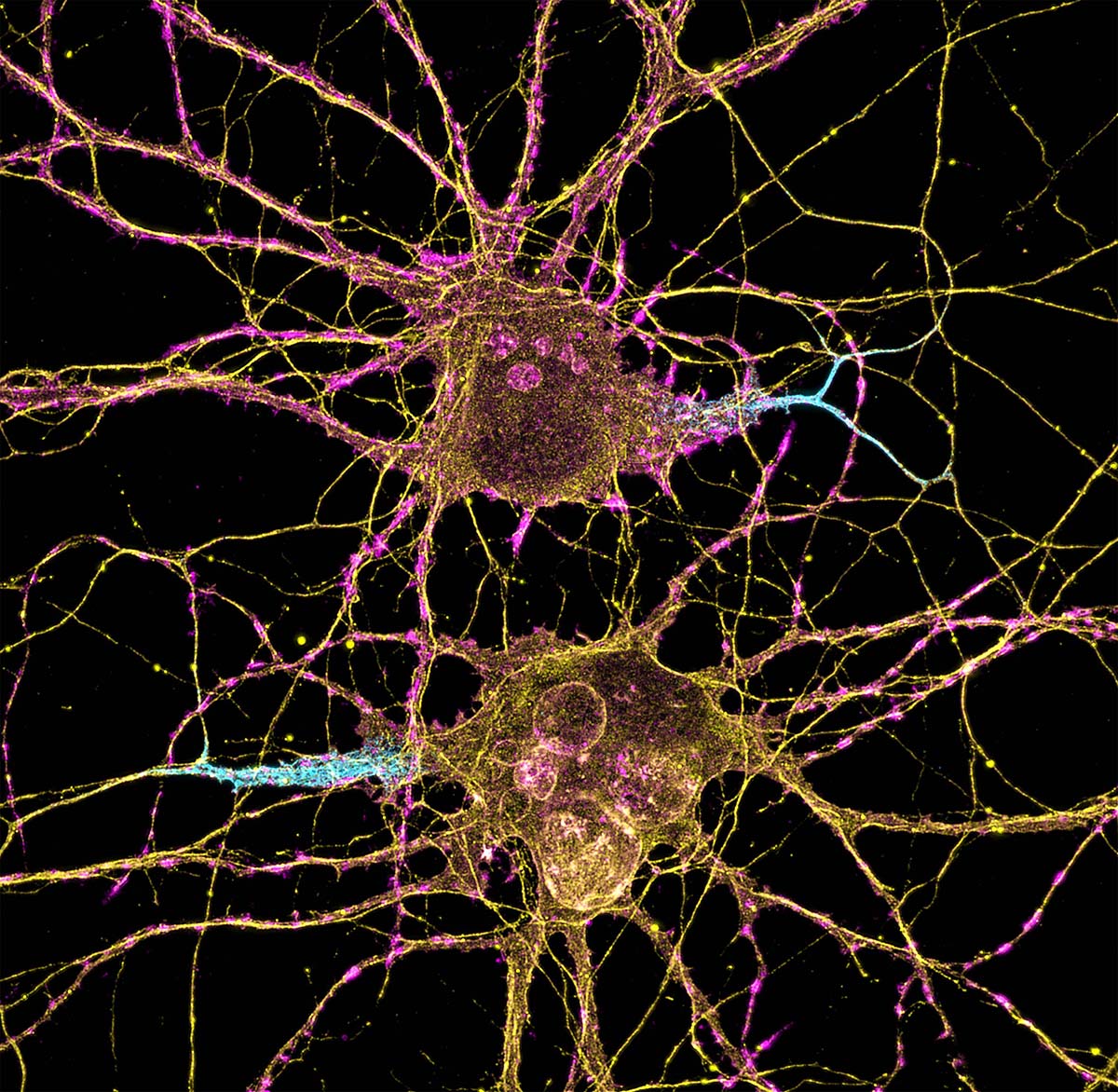 Picture of two neuron cell bodies, side by side. The axon of each neurons is colored blue.