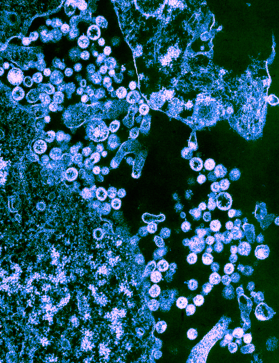 Image of Lassa virus particles