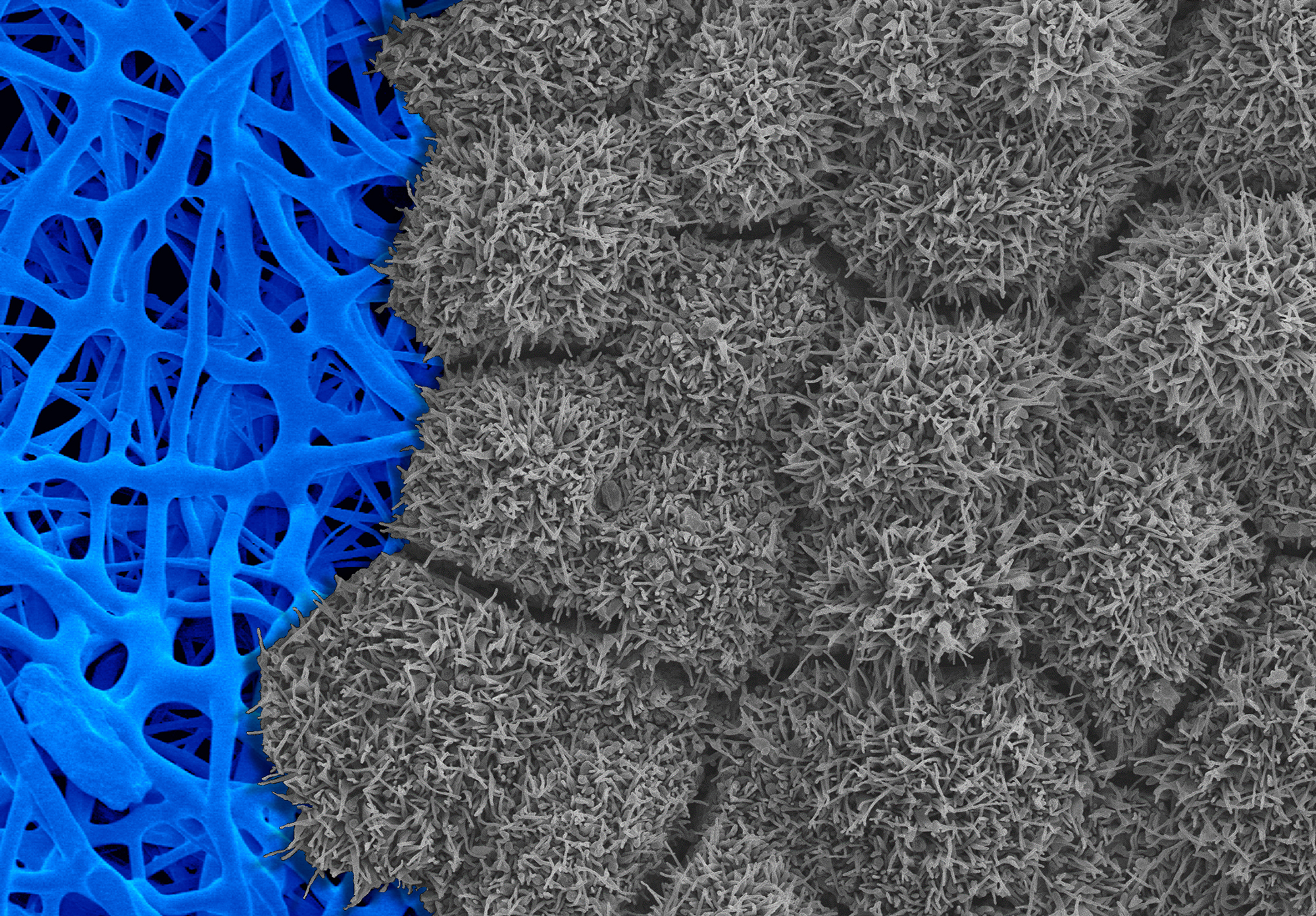 Image of scanning electron micrograph