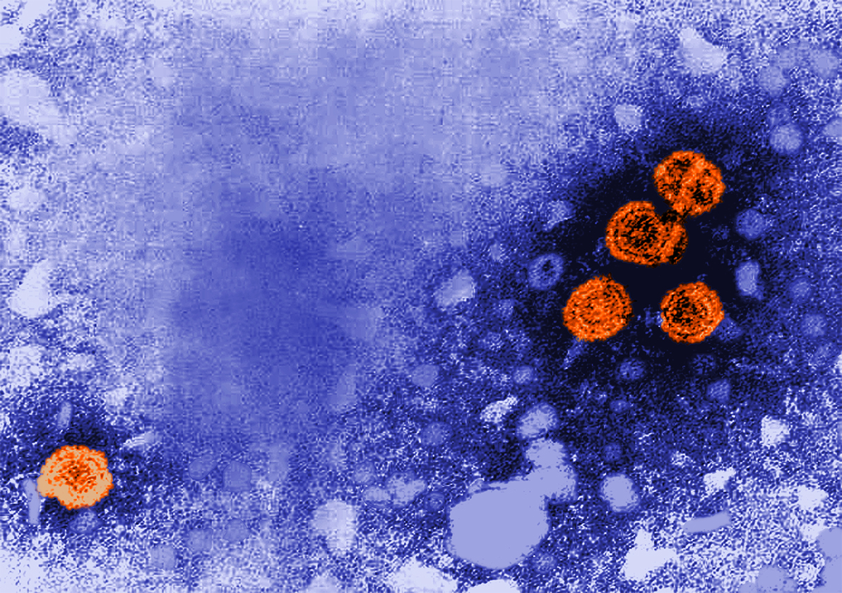 NIH strategic plan details pathway to achieving Hepatitis B cure