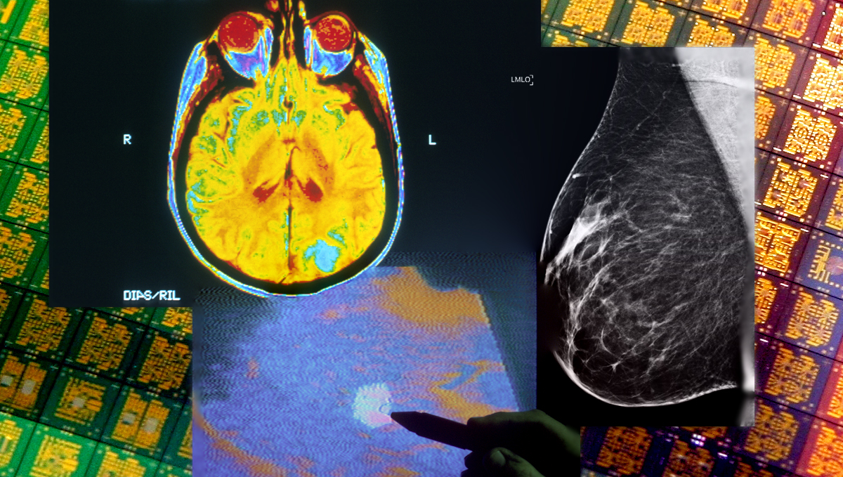 Brain CT, ultrasound, and mammogram overlaid on background image of silicon chips.
