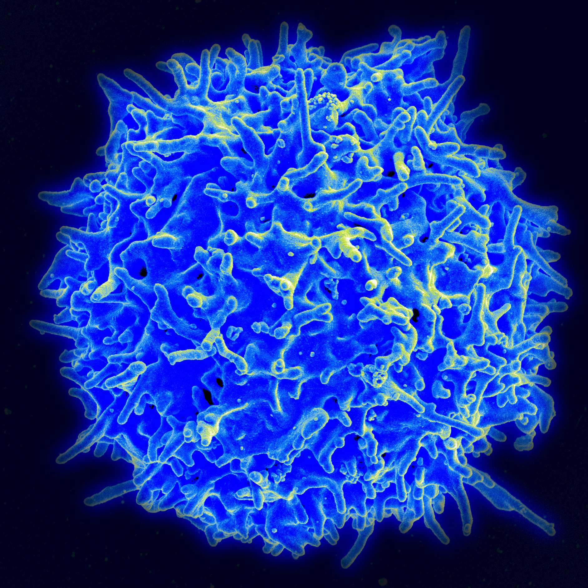 Micrograph of a human T cell Micrograph of a human T cell