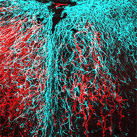 Image of regrowth of nerve fibers