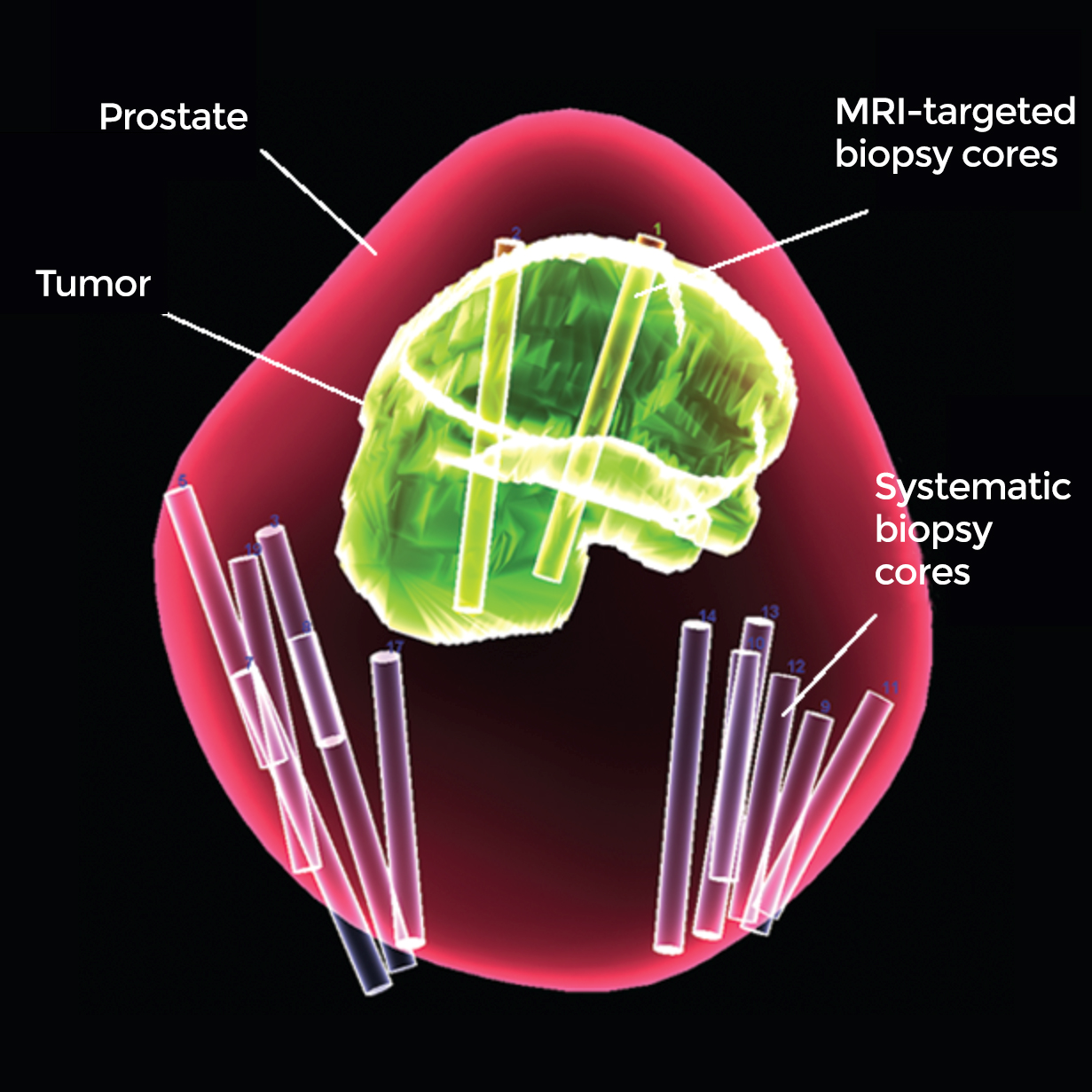 3-D image of the prostate 3-D image of the prostate