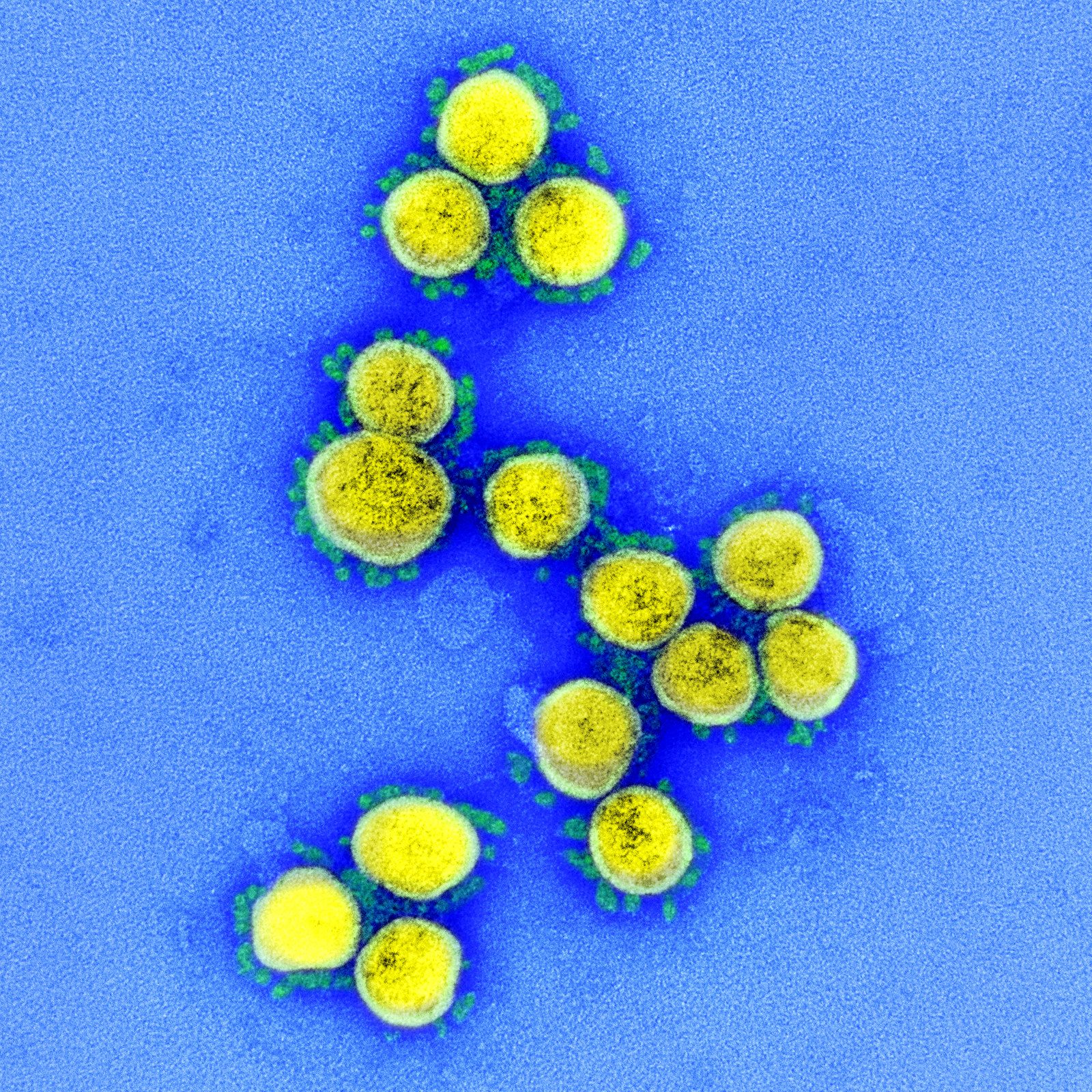 Novel Coronavirus SARS-CoV-2