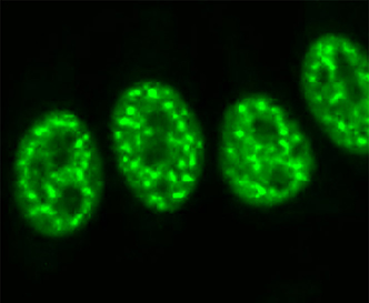 Immunofluorescent staining of human cells shows ANA as bright dots. 