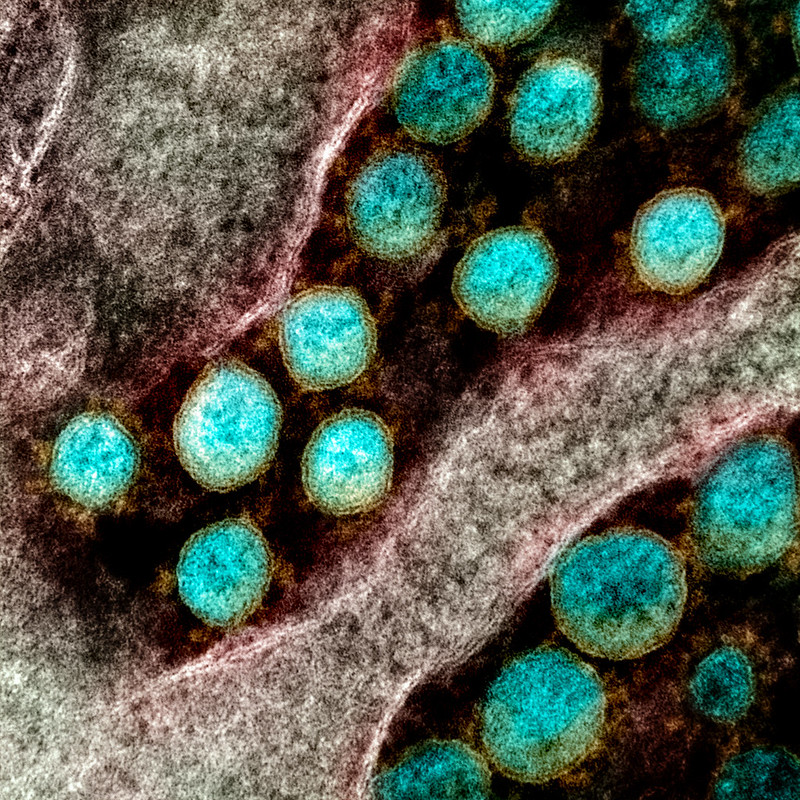 Novel Coronavirus SARS-CoV-2 Novel Coronavirus SARS-CoV-2