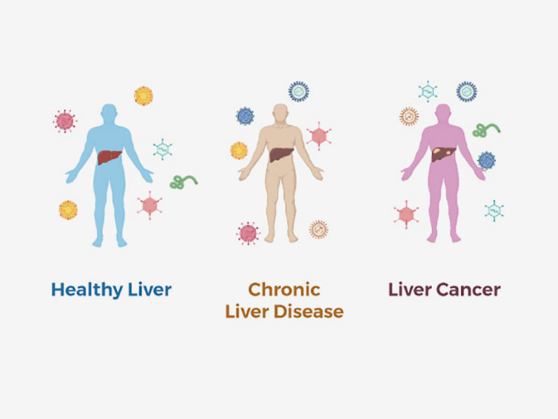 genetic cancer of liver