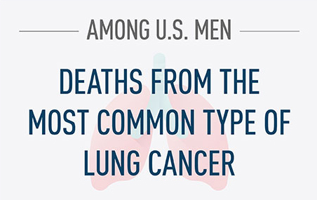Among U.S. men deaths from the most common type of lung cancer...