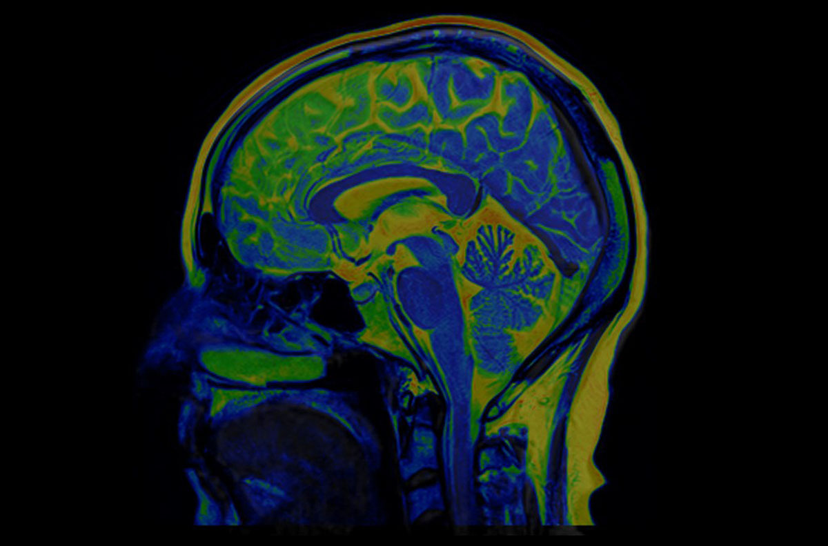 Brain scan stock image