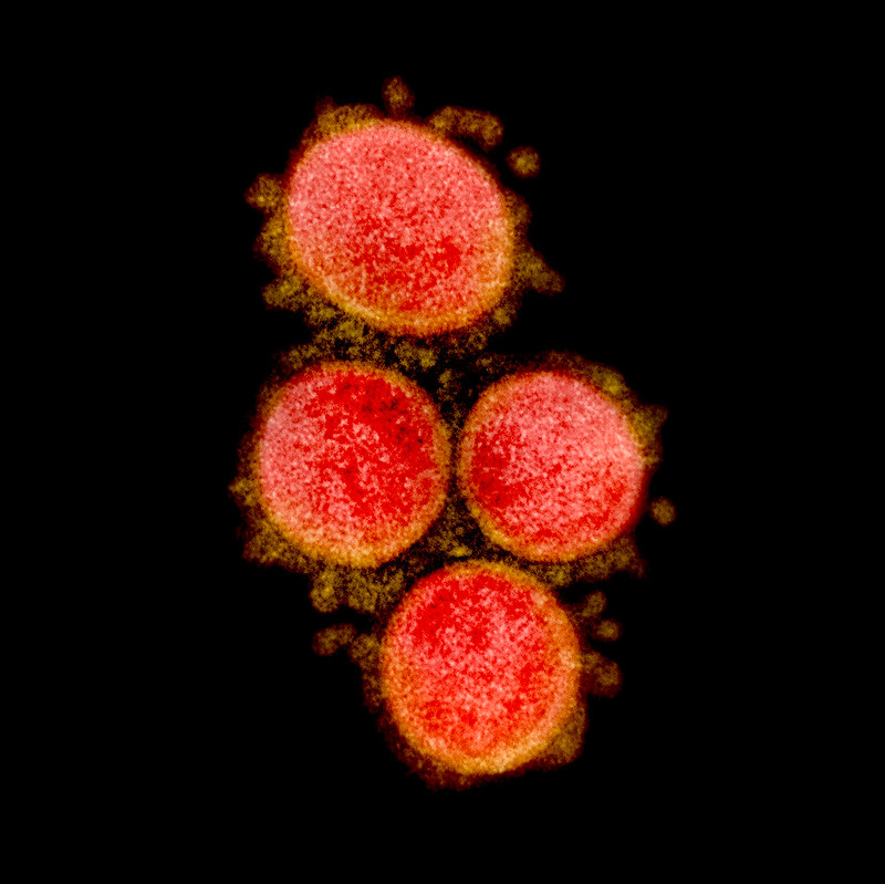 Novel Coronavirus SARS-CoV-2 Novel Coronavirus SARS-CoV-2