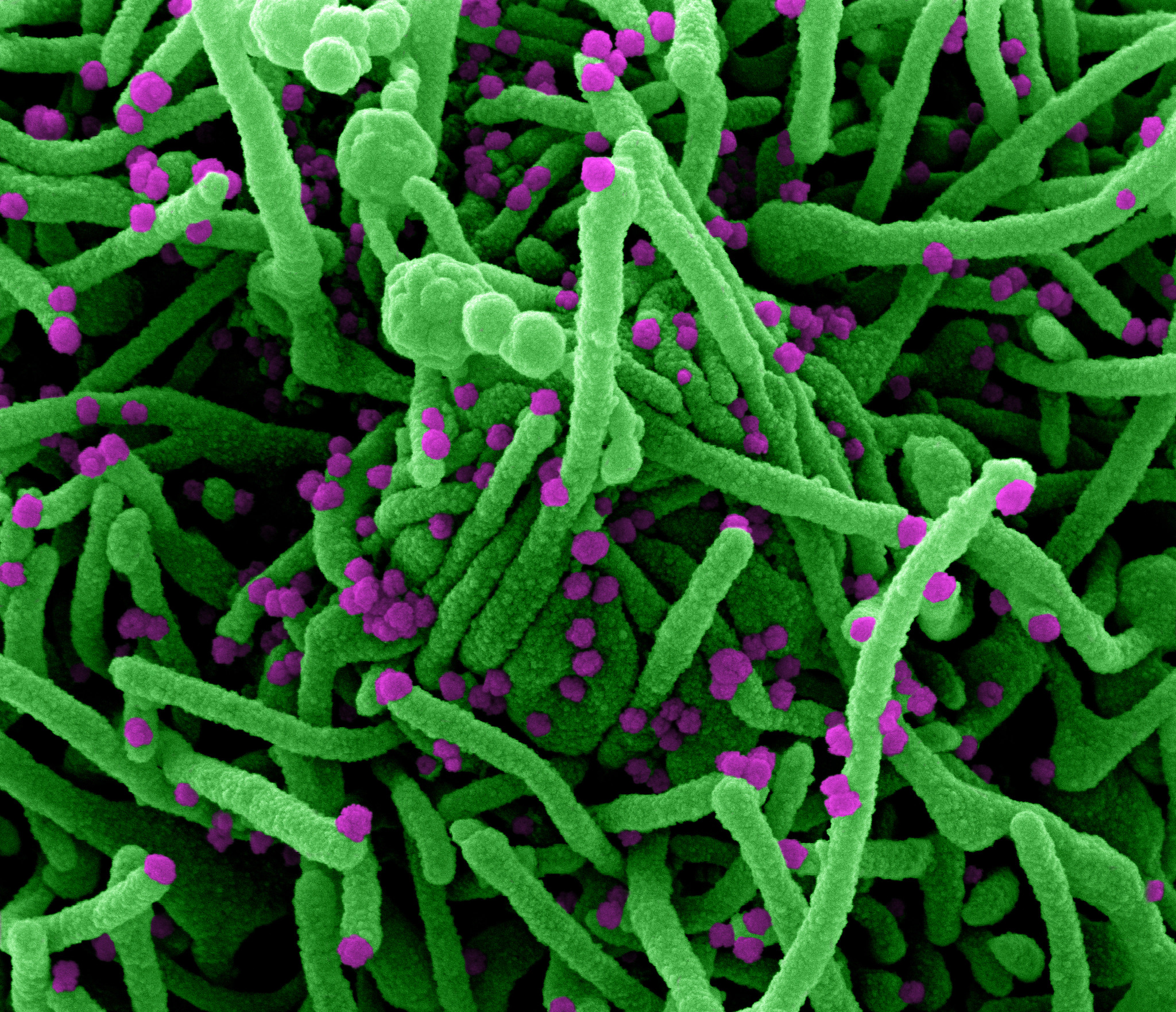 Novel Coronavirus SARS-CoV-2 Novel Coronavirus SARS-CoV-2