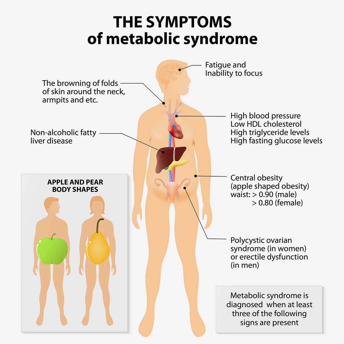 A human body diagram of metabolic syndrome