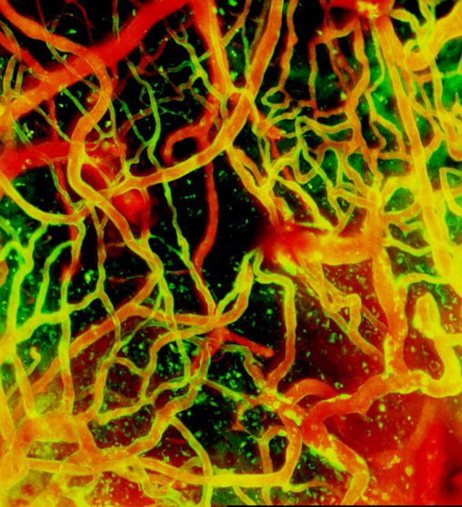 Image of mouse brain blood vessels one day and ten days after injury. 