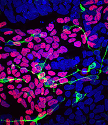 Fluorescent microscopy image of induced pluripotent stem cells