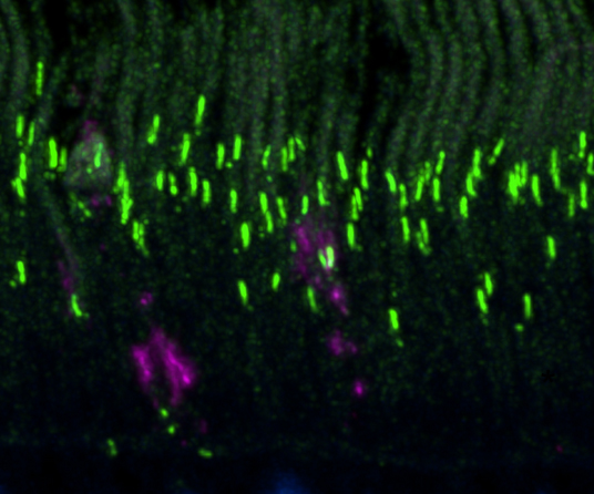 (left panel) Early in prion infection, a prion protein aggregate (magenta) blocks the entrance to a cilium (green) in a retinal photoreceptor. (lower right) In prion-infected retina, prion protein (magenta) accumulates under the horseshoe-shaped ribbon sy