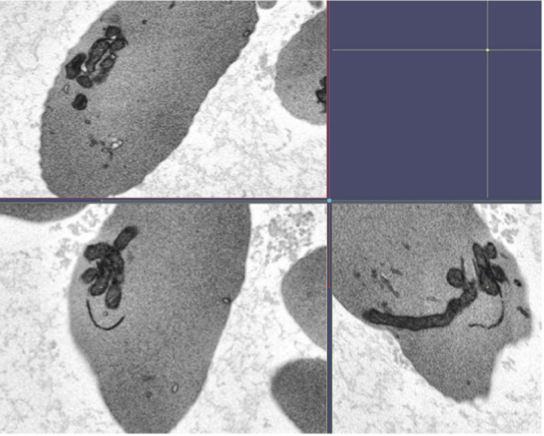 Image of mitochondrial bundles in sickle cell red blood cells