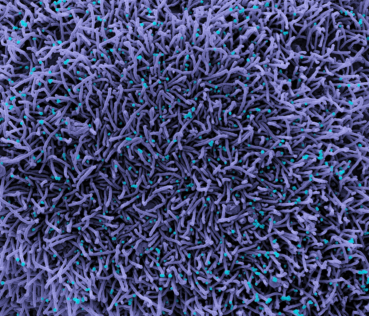 Novel Coronavirus SARS-CoV-2