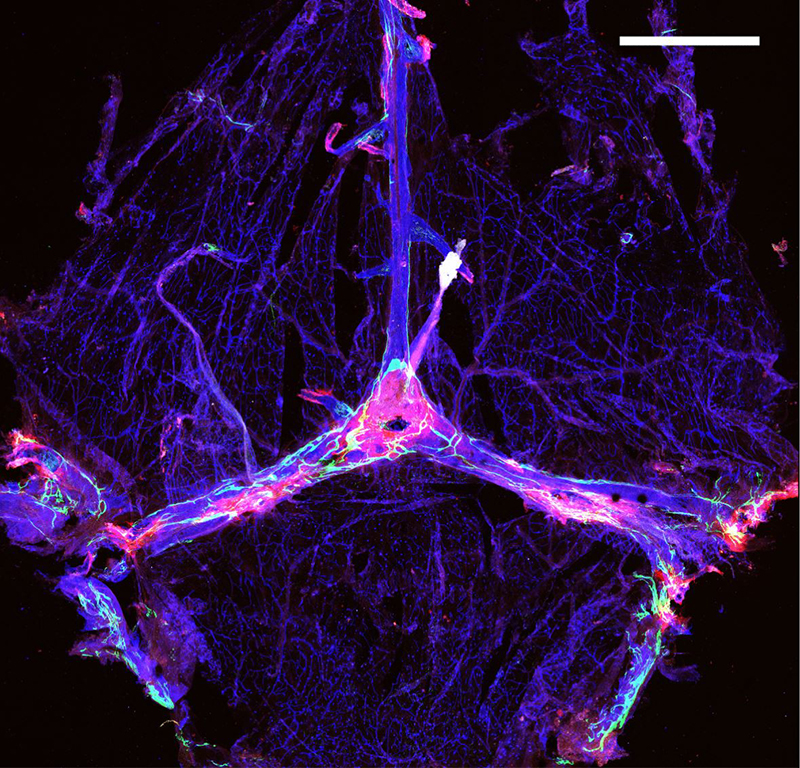 The meningeal lymphatic vessels are in green, the blood vessels are in blue and amyloid beta is in red.