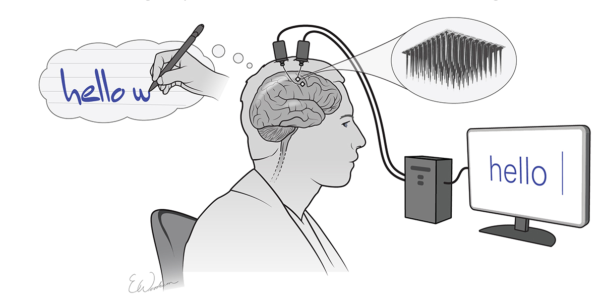 Cartoon of man thinking about writing a sentence while electrodes implanted into his brain send a signal that appears as words on a computer screen