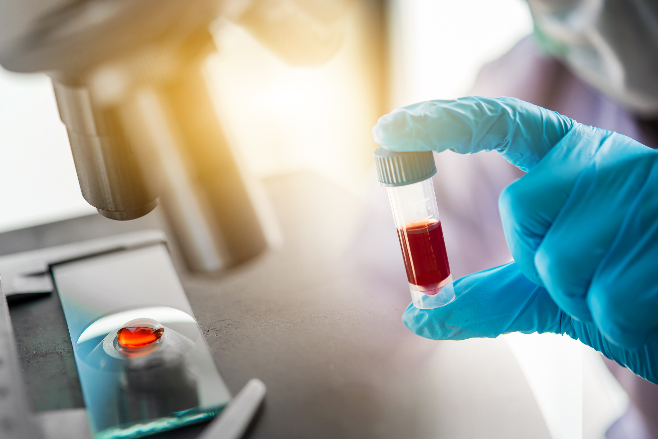 lab technician assistant analyzing a blood sample in test tube at laboratory with microscope. Medical, pharmaceutical and scientific research and development concept. 