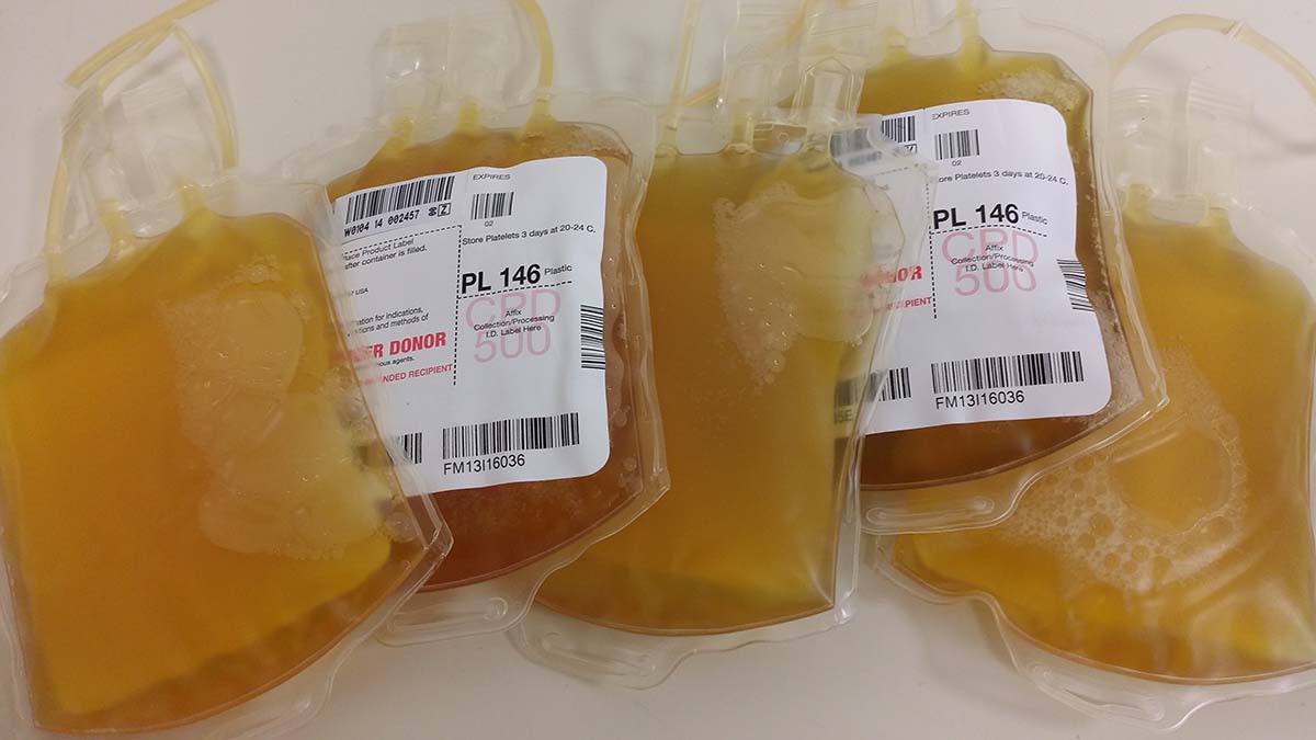 Bags of liquid plasma that have been donated by patients and are awaiting use