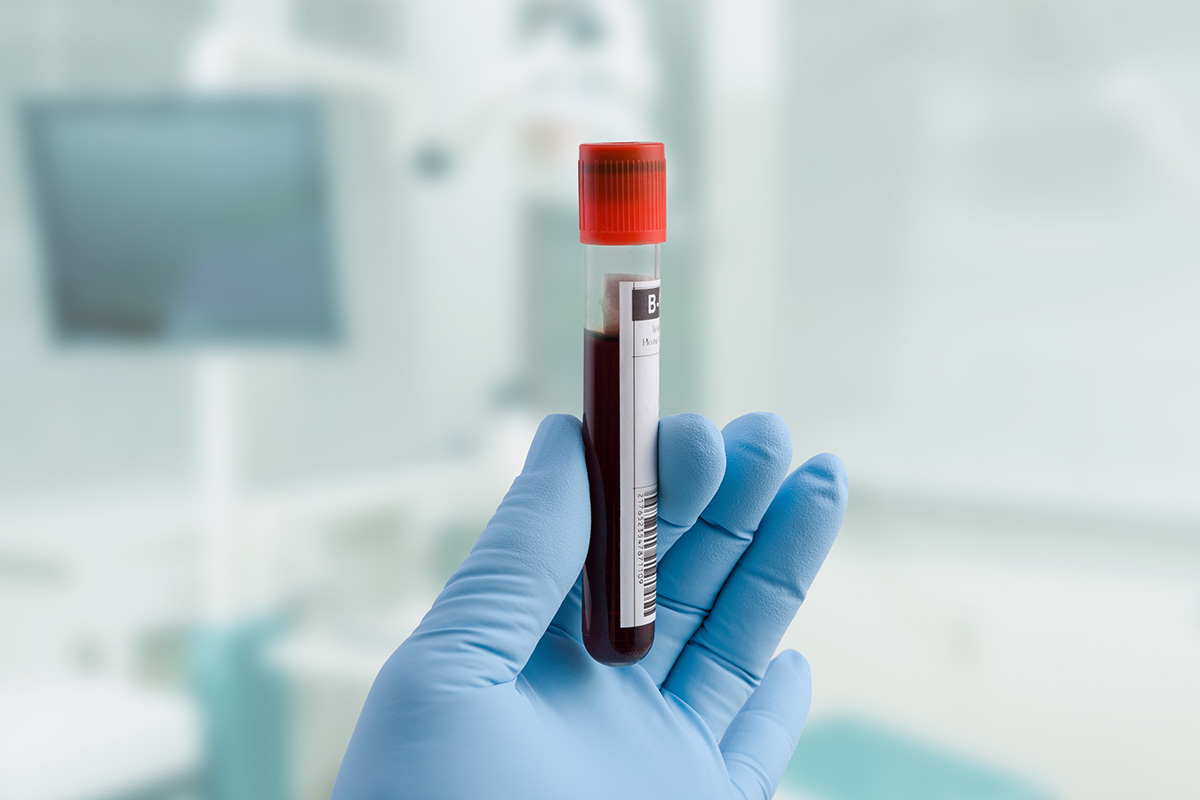 In a common genetic disorder, blood tests reveal when benign tumors become cancerous