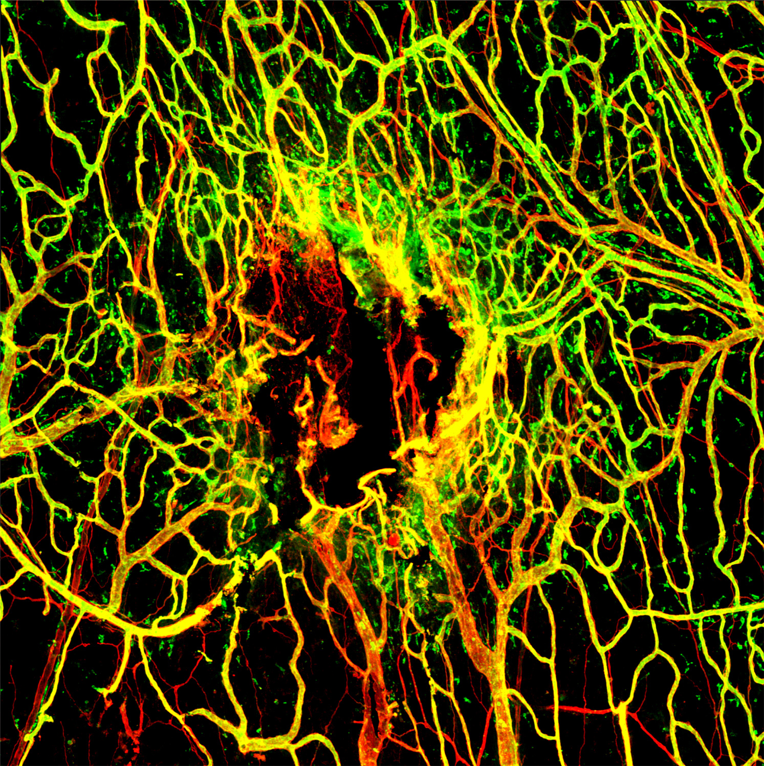 Viral Infection Slows Blood Vessel Repair After TBI: Seven days after mTBI, the blood vessels (stained in red) in the tissues around the brain are not completely repaired. A marker for intact vessels was used (labeled in green) to distinguish fully functi