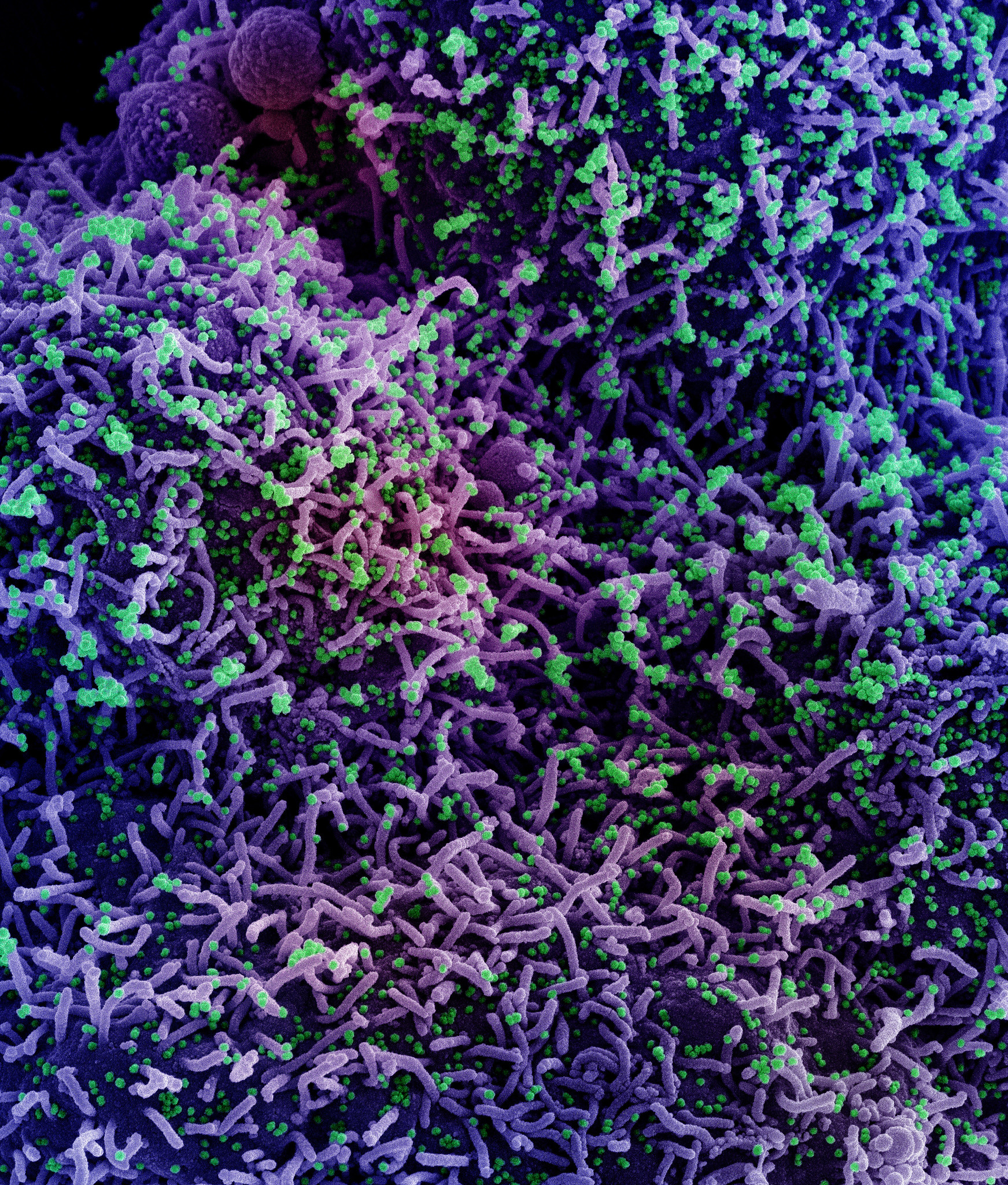 Novel Coronavirus SARS-CoV-2