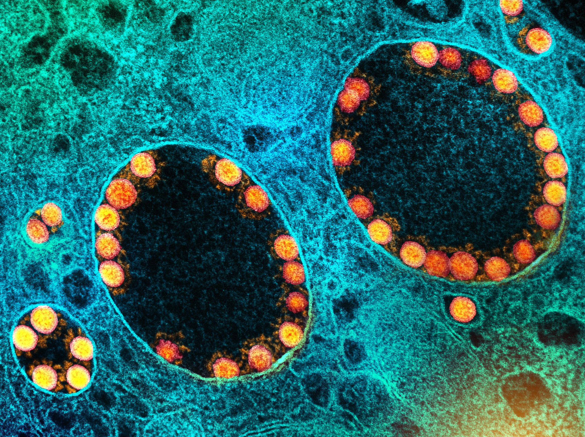 Novel Coronavirus SARS-CoV-2 Novel Coronavirus SARS-CoV-2