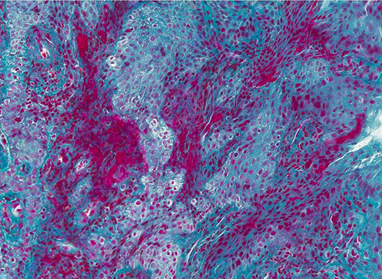 A fluorescence microscopy image of human gum tissue. 