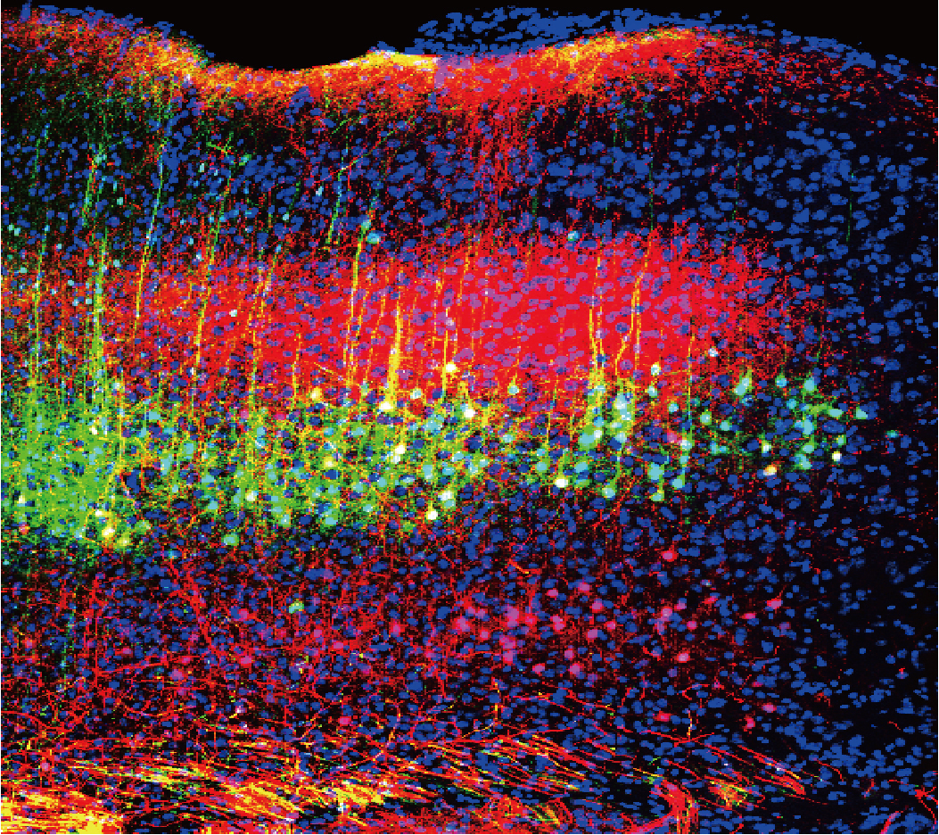 Image of green and magenta neurons in mouse auditory cortex