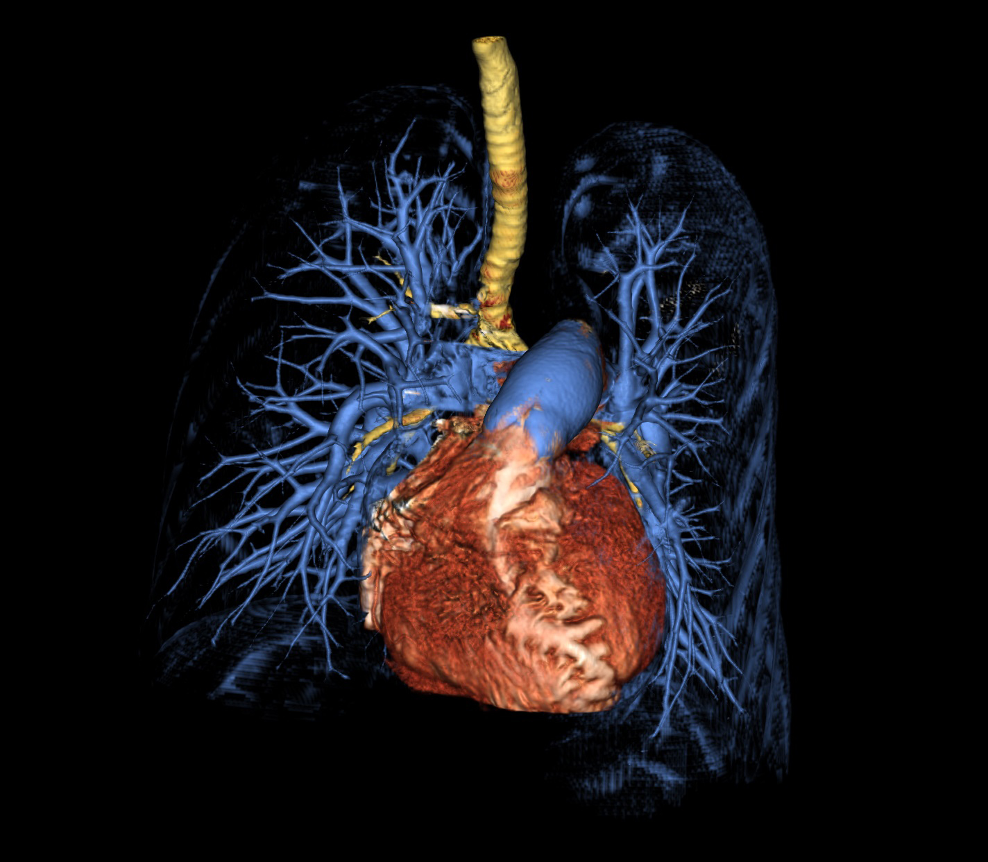 Image of a 3D rendering of the lungs and heart 