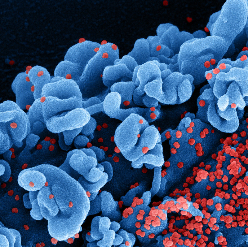 Novel Coronavirus SARS-CoV-2 (Omicron)