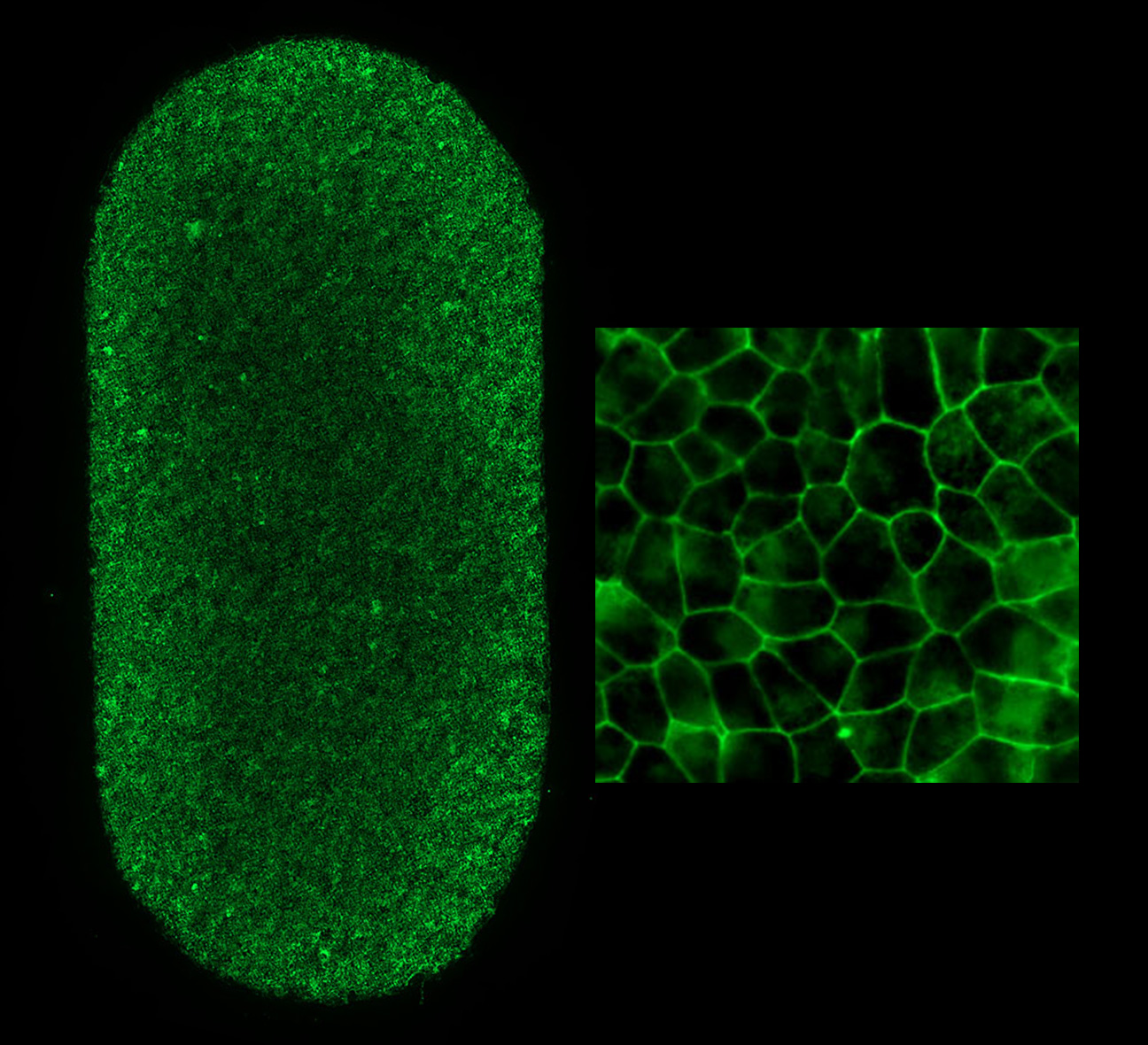 Image of RPE patch Image of RPE patch