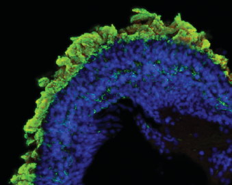 Grid with six images of retinal organoids stained blue red and green