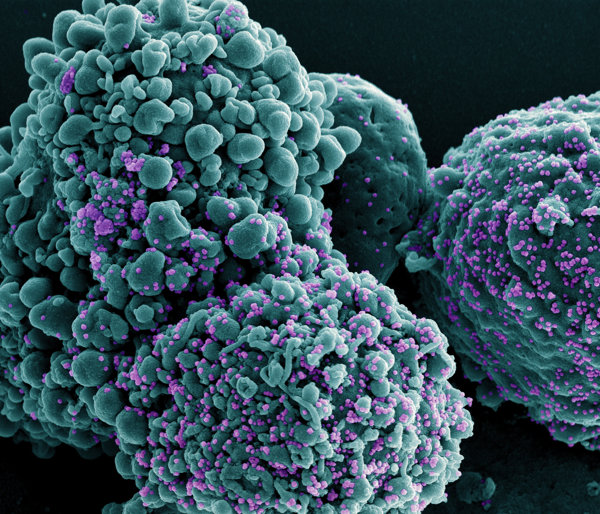 NIH seeks the subsequent era of COVID-19 diagnostics