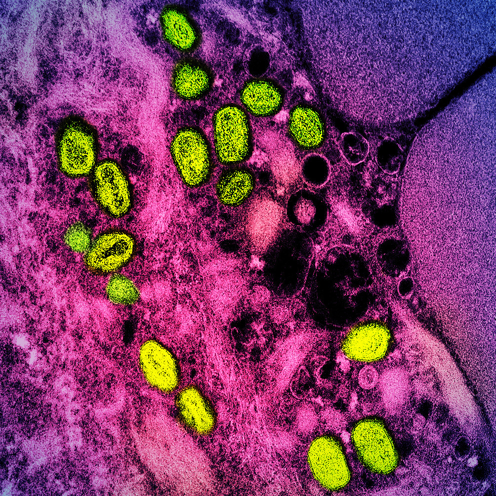 Green monkeypox particles in an infected cell visualized in pink and purple