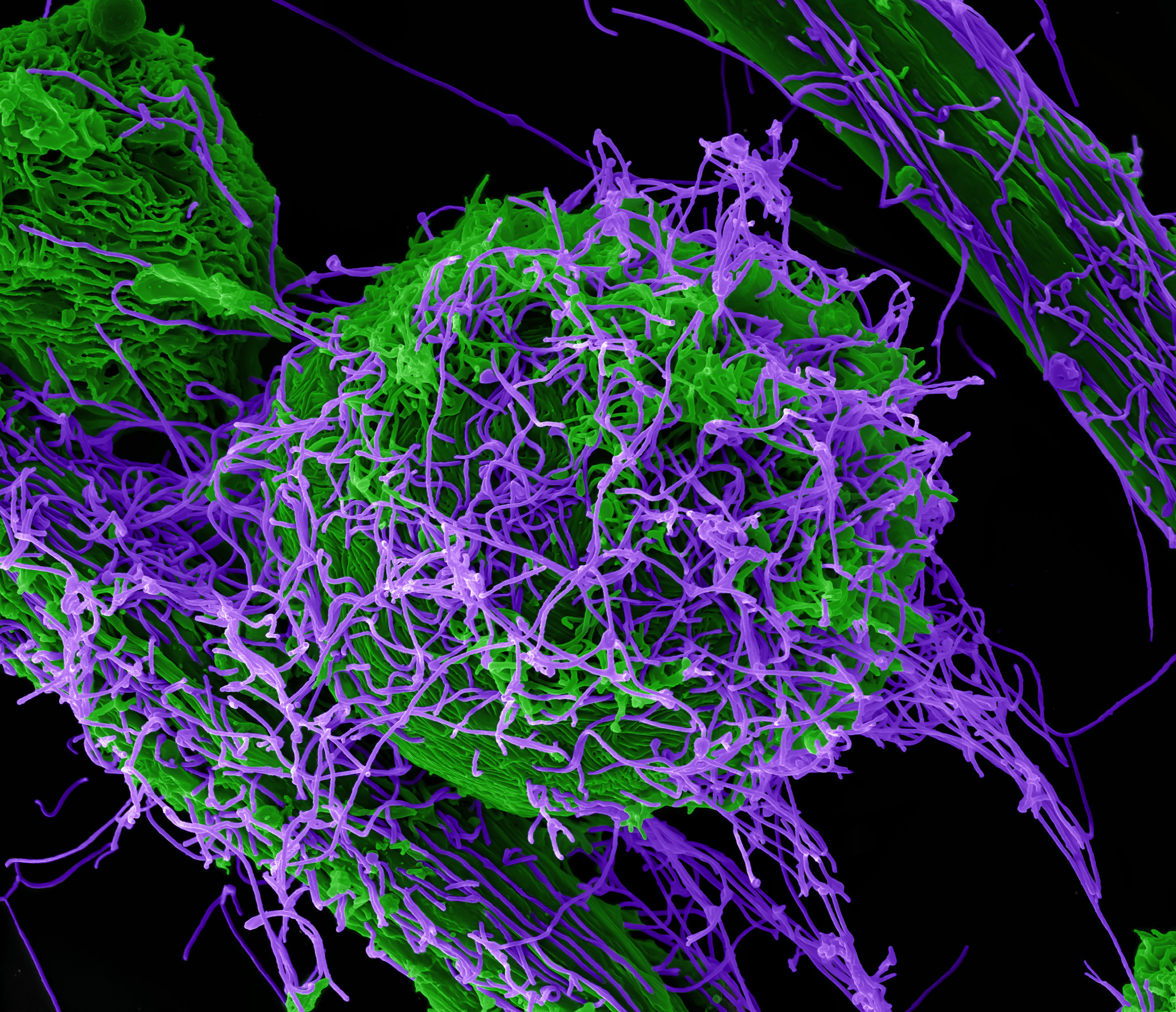 Ebola Virus Particles