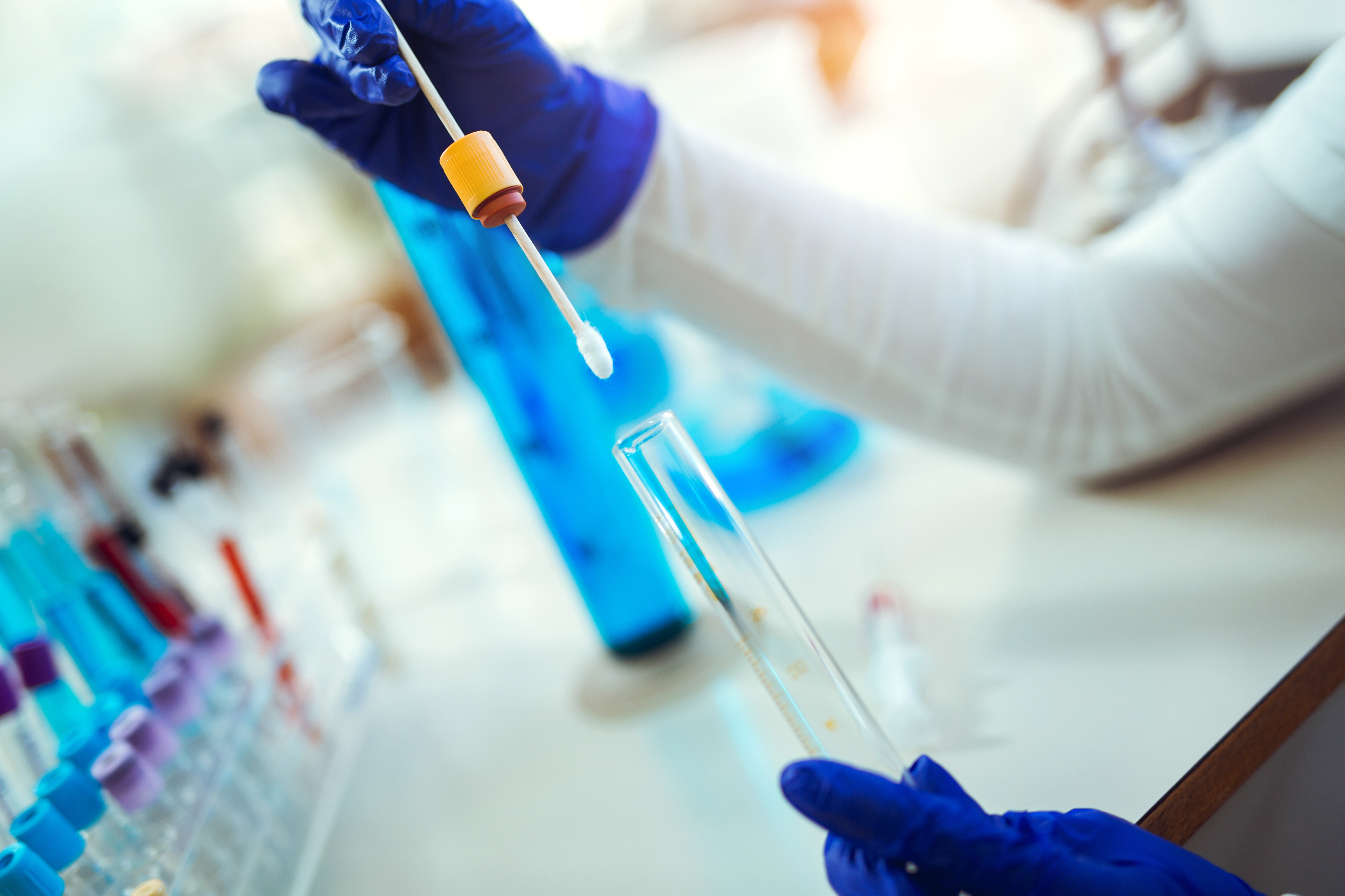 Image of a scientist holding a swab and test tube.