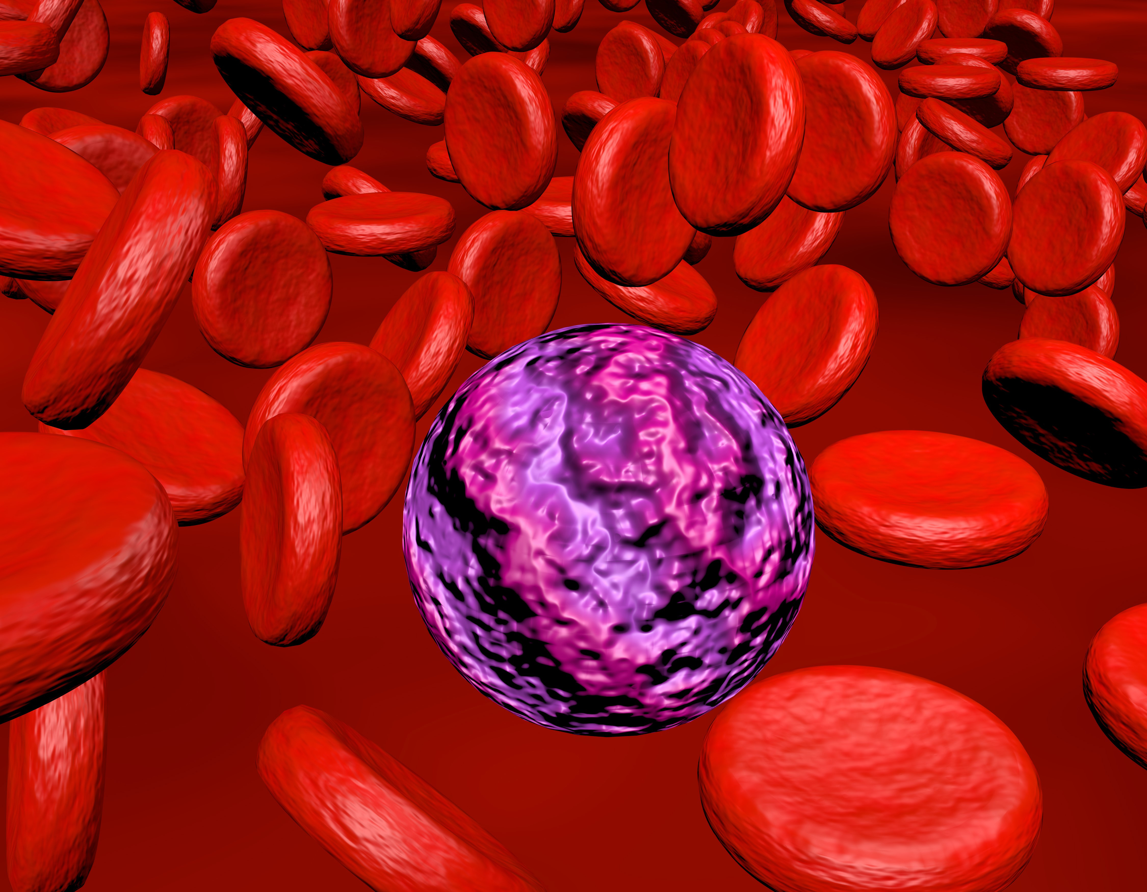 3D rendering of acute myeloid leukemia