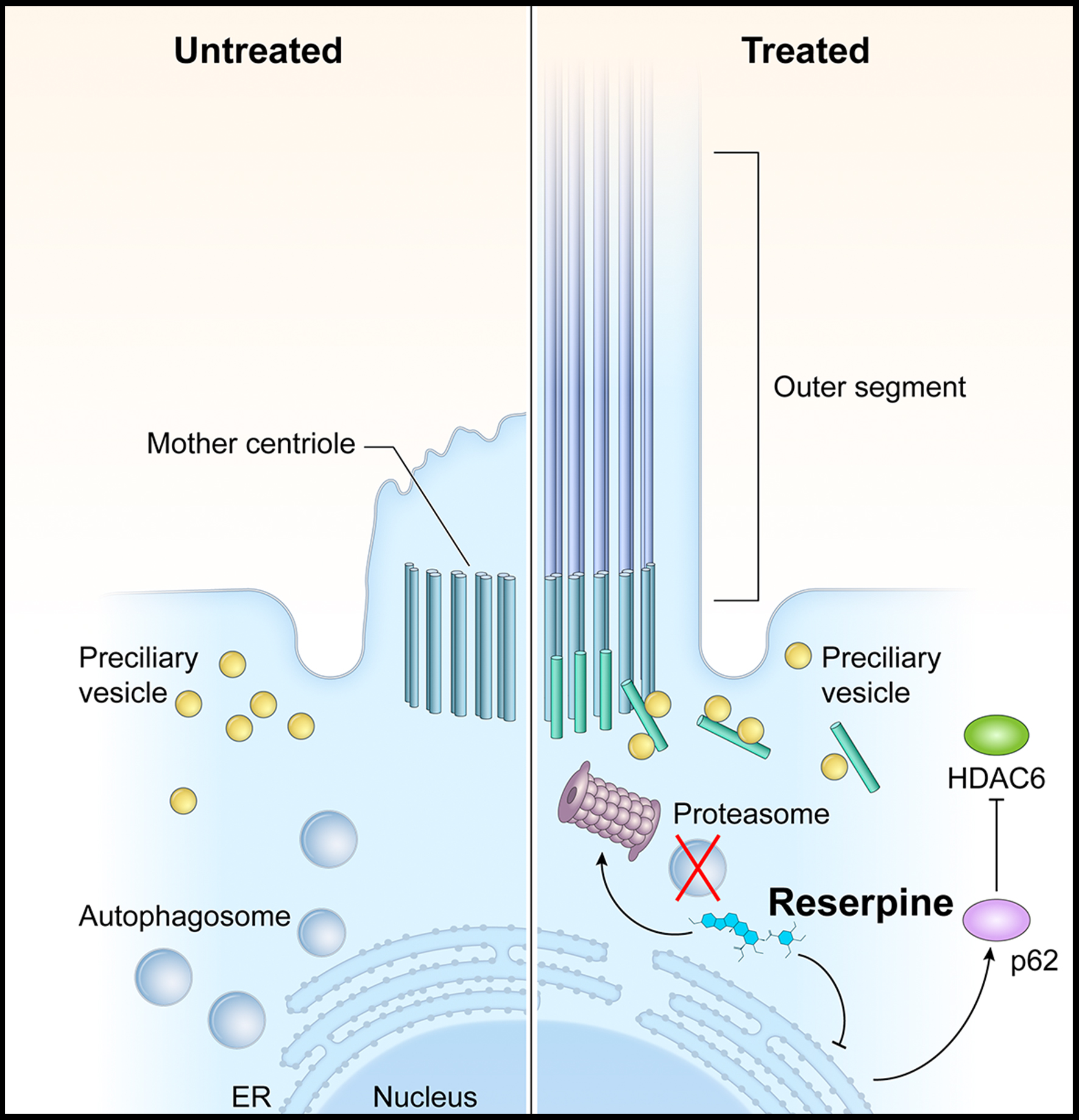 FDA-approved drug shows promise in lab models for blinding childhood disease