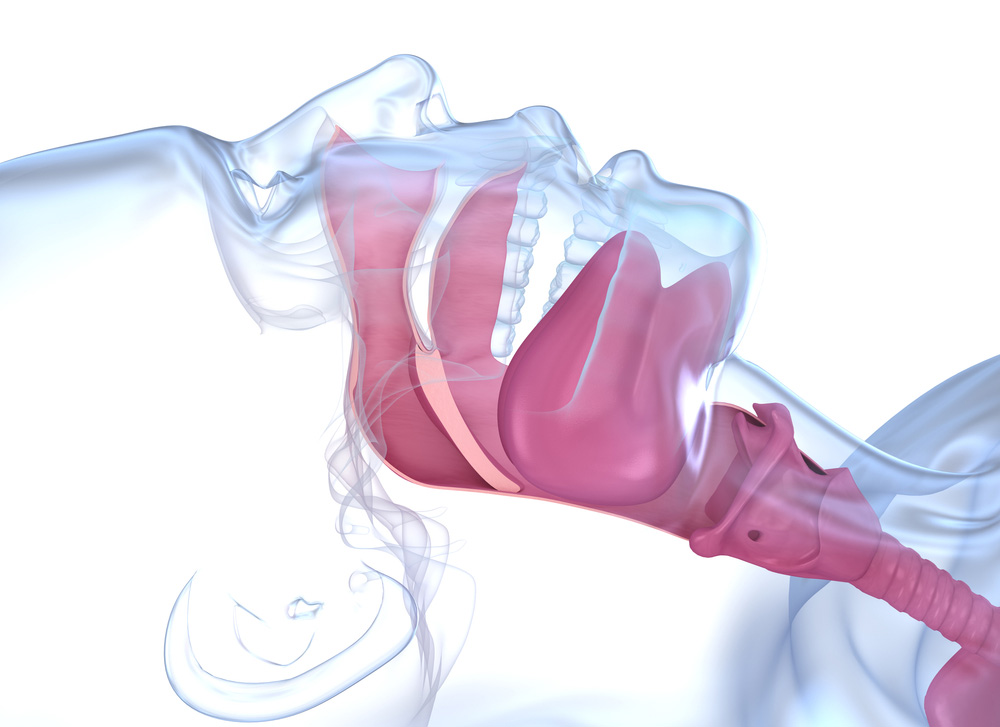 Anatomy illustration of sleep apnea