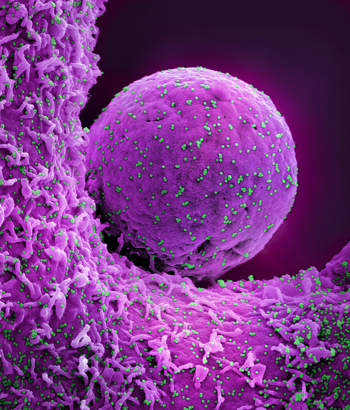 Novel Coronavirus SARS-CoV-2 (Omicron) Novel Coronavirus SARS-CoV-2 (Omicron)
