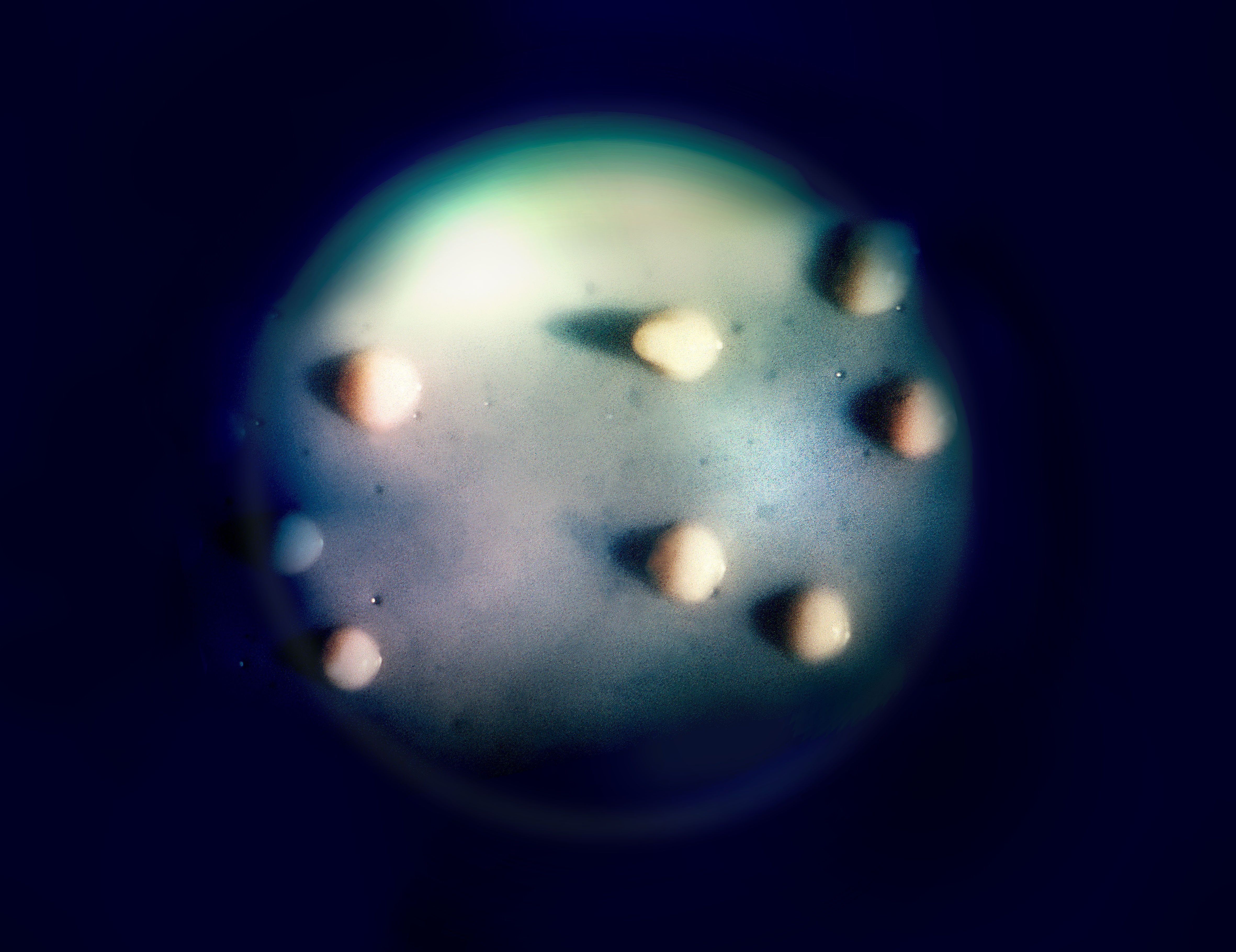 Cultivated colonies of the bacterium Mycobacterium avium appear as eight, round beige objects inside a round petri dish. The dish appears as a faded, dim, blue-green background surrounded by the color black. Cultivated colonies of the bacterium Mycobacterium avium appear as eight, round beige objects inside a round petri dish. The dish appears as a faded, dim, blue-green background surrounded by the color black.