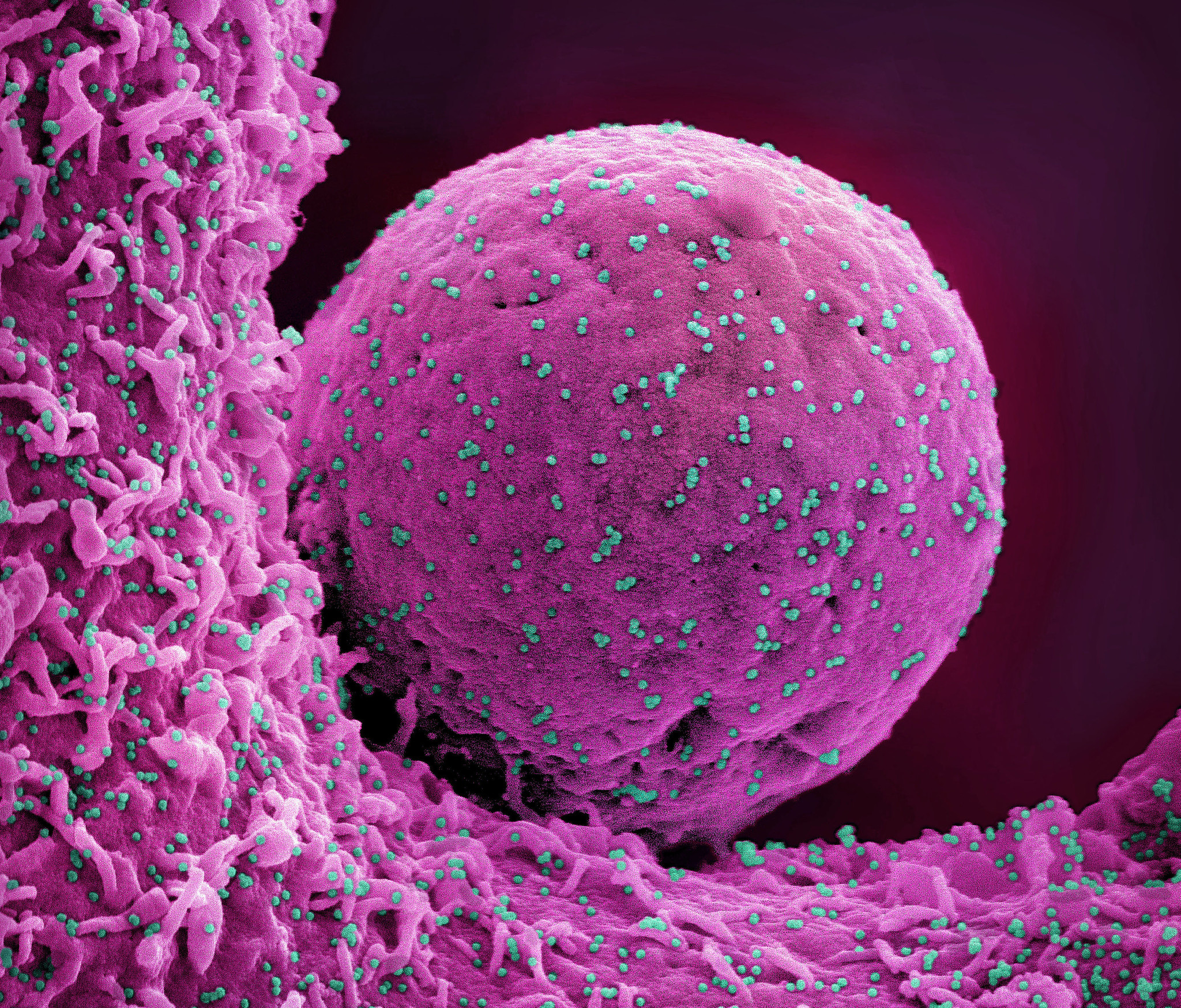 Novel Coronavirus SARS-CoV-2 (Omicron) Novel Coronavirus SARS-CoV-2 (Omicron)
