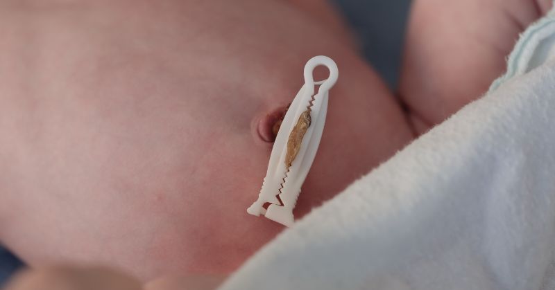 Image of an umbilical cord clamp on a newborn.