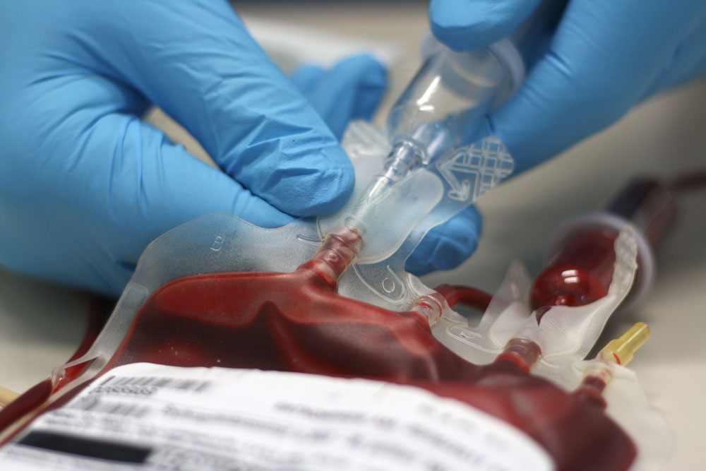 Image of a pint of blood for a transfusion