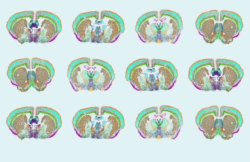 Scientists unveil complete cell map of a whole mammalian brain Image compilation showing scans of many mouse brains
